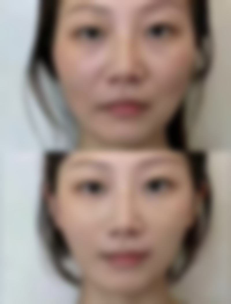 周春花预约方式及价格表