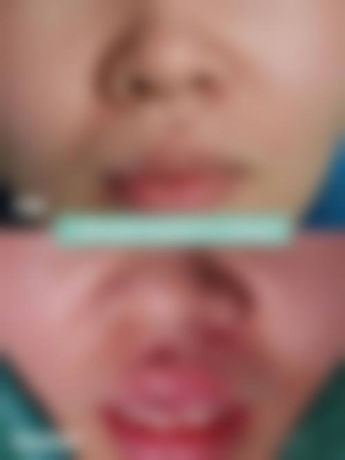 北京炫美整形美容医院擅长项目