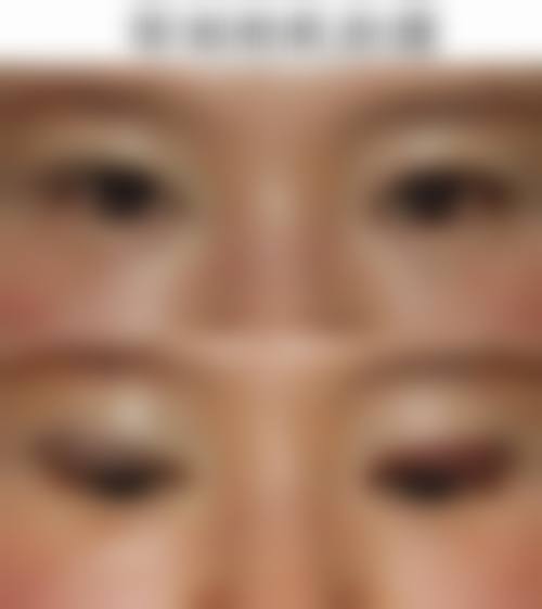 张家界依莱美医疗整形医院实例参考