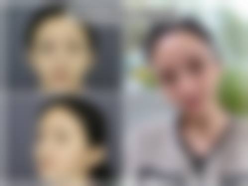 郑州帝尔美整形美容门诊部价格表（仅供参考）