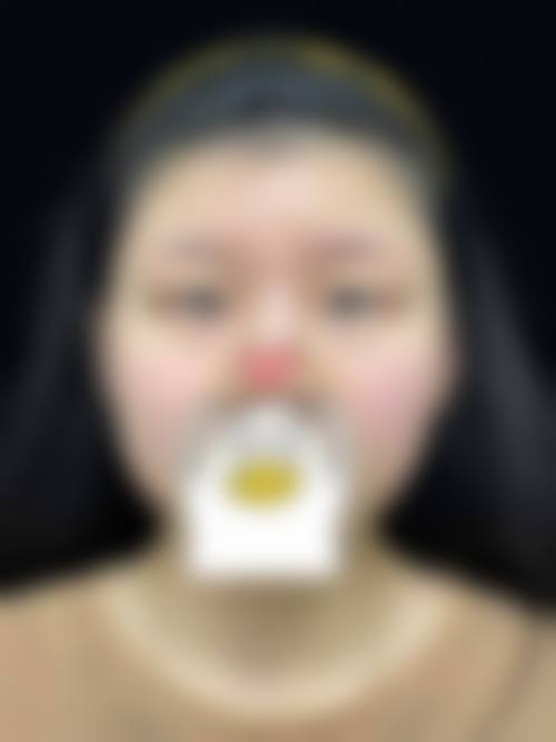 苏州苏城医院整形美容科怎么预约？