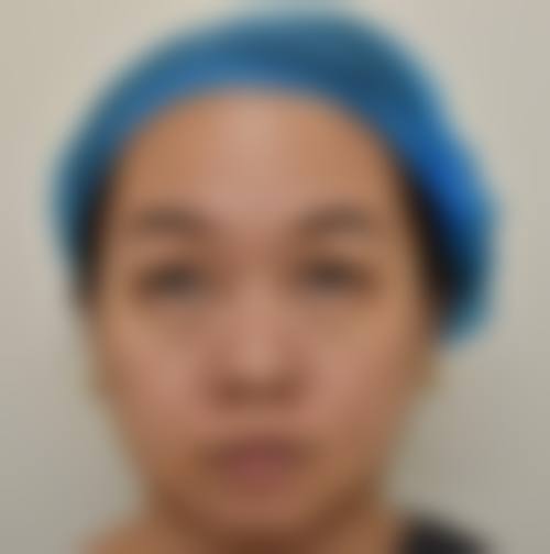 慈溪圣爱医院整形美容科擅长项目