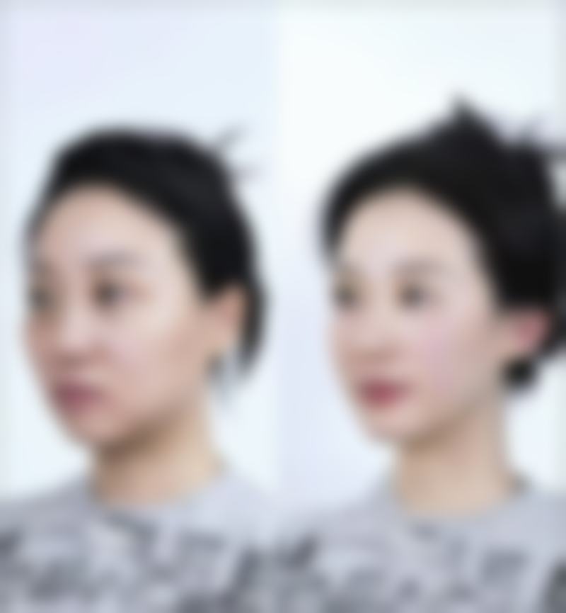 南宁美冠医疗美容诊所价格表（仅供参考）