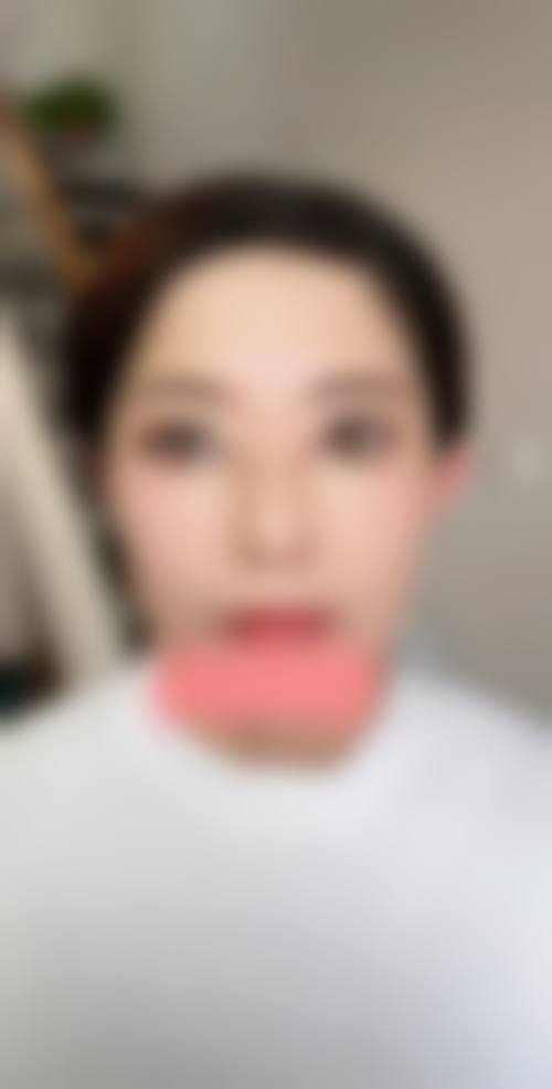 保山星耀医疗美容门诊部实例参考