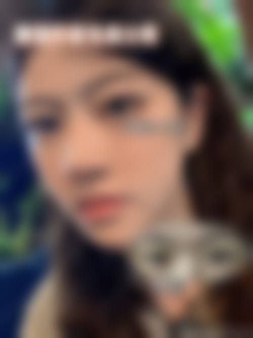 内蒙古华医整形医疗美容实例参考
