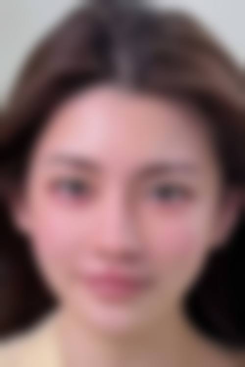 哈尔滨华美整形美容医院擅长项目