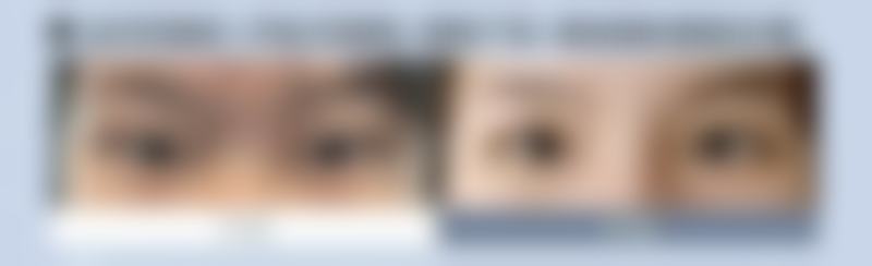 深圳美臣医疗美容医院怎么预约?