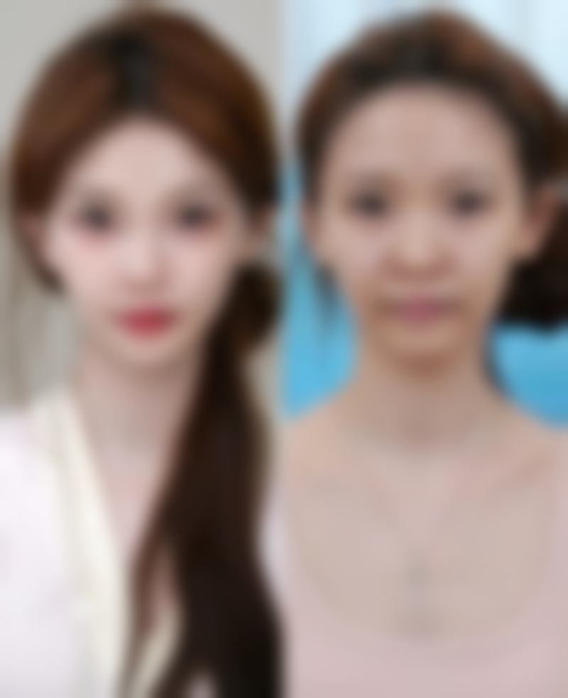 天津瑞丽诗医疗美容门诊实例参考