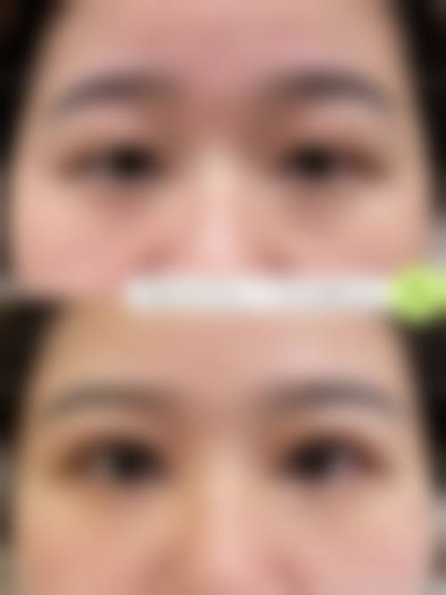 长春李荫良医疗美容诊所价格表（仅供参考）
