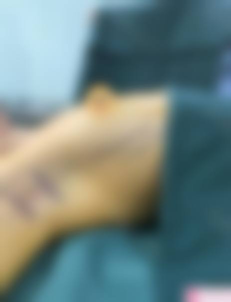 成都高新置美归璞医疗美容诊所价格表（仅供参考）