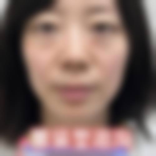 汉中市中 心医院(医疗美容·整形外科)实例参考