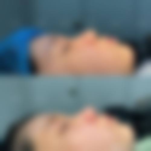 清远市人民医院(医疗美容科)怎么预约？