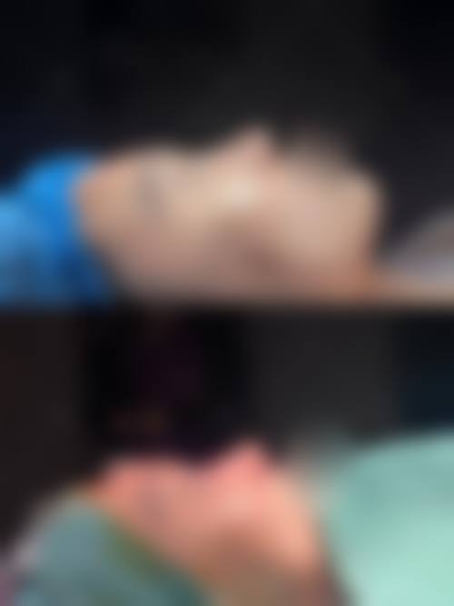 兰州妃漾医疗美容诊所实例参考