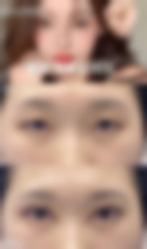 韩国THANKYOU整形外科实例参考