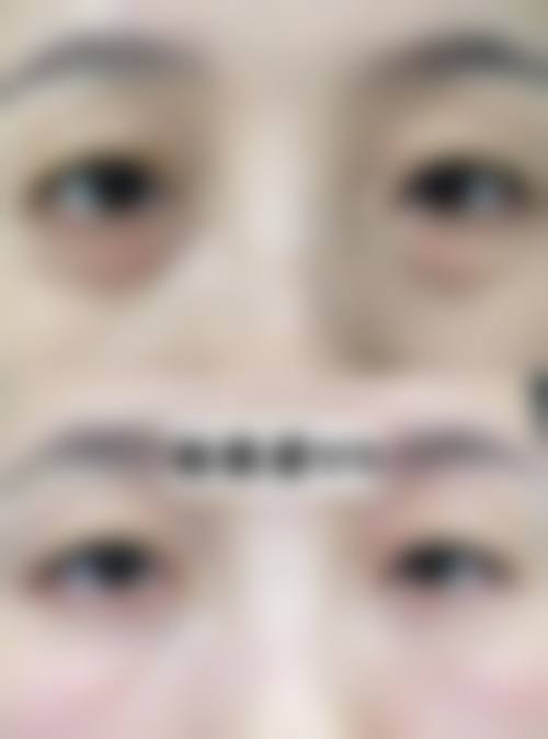 长沙上美整形医院擅长项目