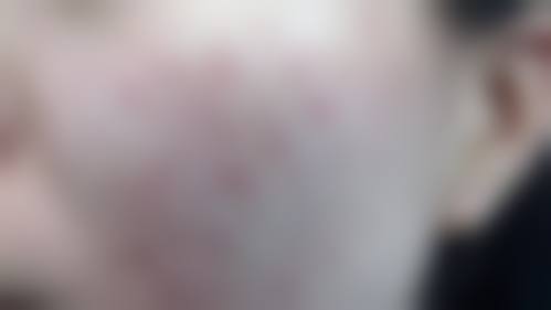 武汉恩喜医疗美容门诊部擅长项目