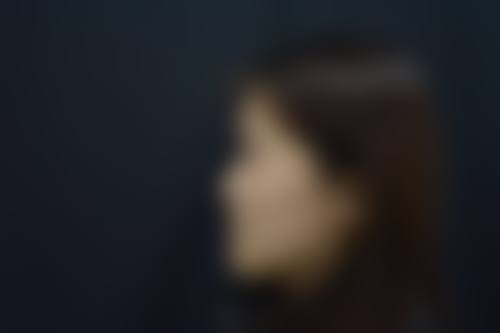 长沙上美整形医院实例参考