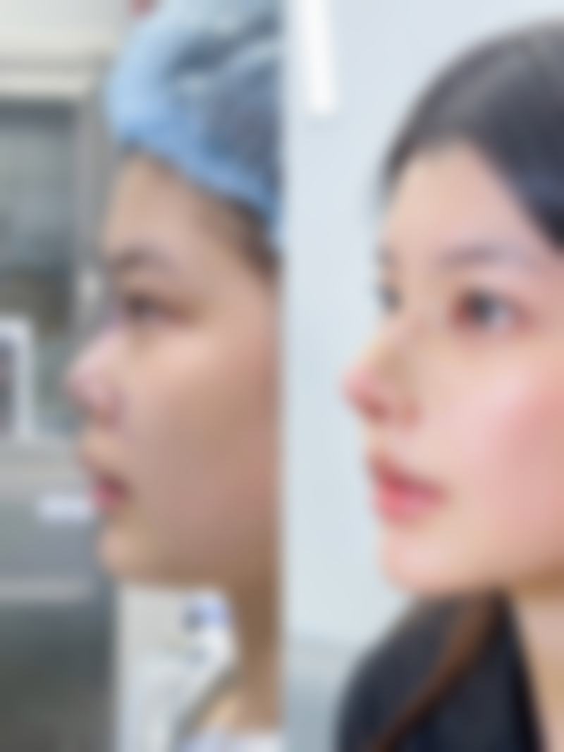 郑州缔莱美整形医疗美容医院价格表(仅供参考)