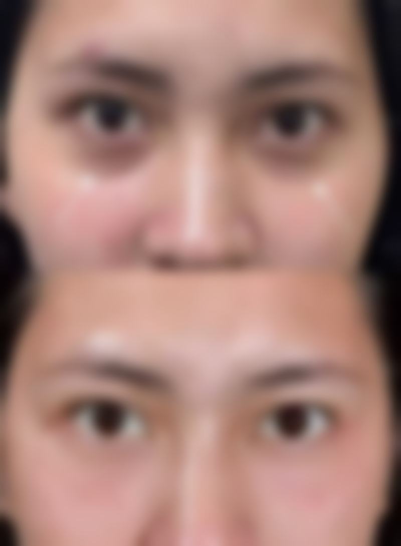 北京宝岛医院整形美容科实例参考