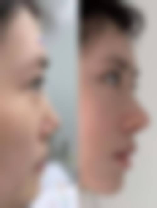 杭州星颜医疗美容诊所怎么预约?