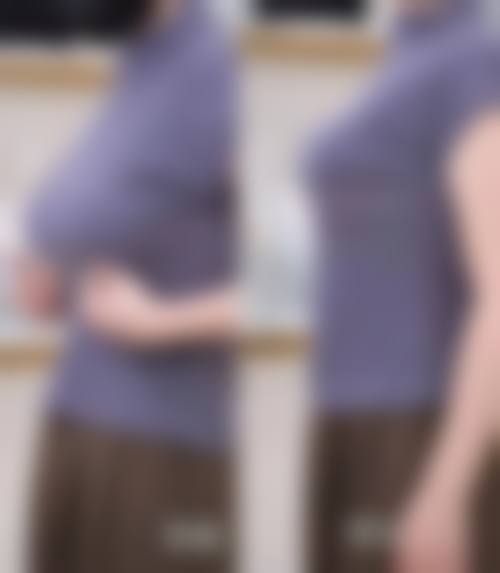 东莞南城知美医疗整形美容医院怎么预约？