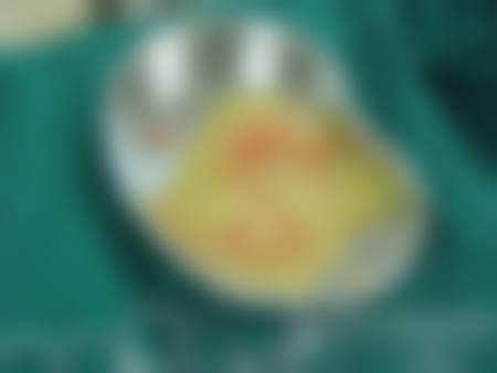 东莞南城知美医疗整形美容医院价格表（仅供参考）