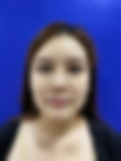 湖南曹家整形美容医院实例参考