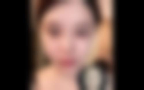 沈阳朗丽整形美容诊所实例参考