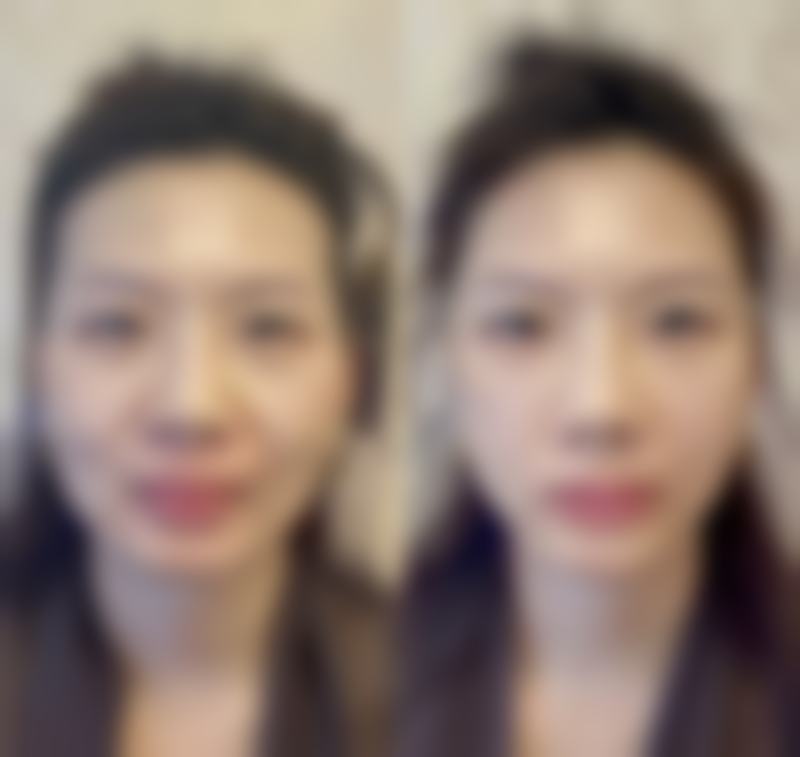 陈秀芸患者评价