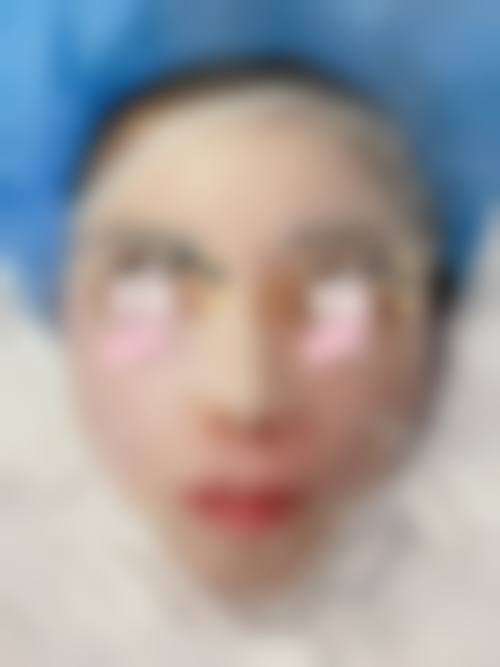 兰州黛美尔医学美容机构擅长项目