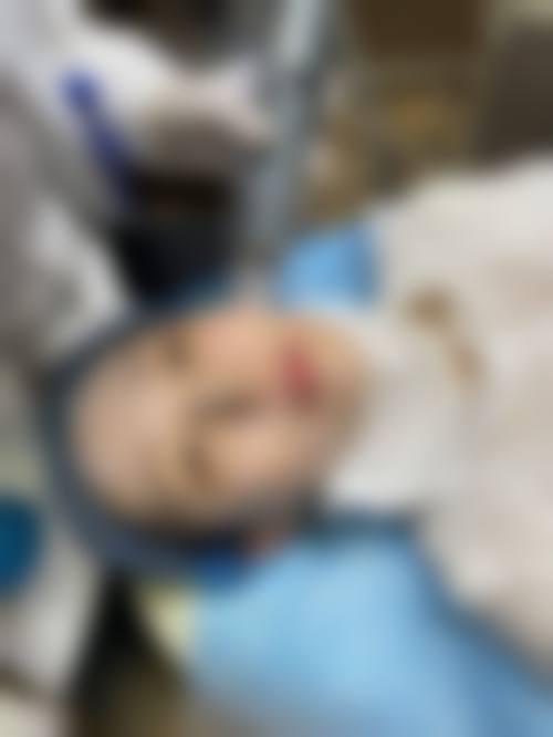 昆明海峡整形美容医院实例参考