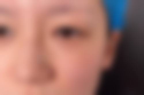 昆明海峡整形美容医院价格表（仅供参考）