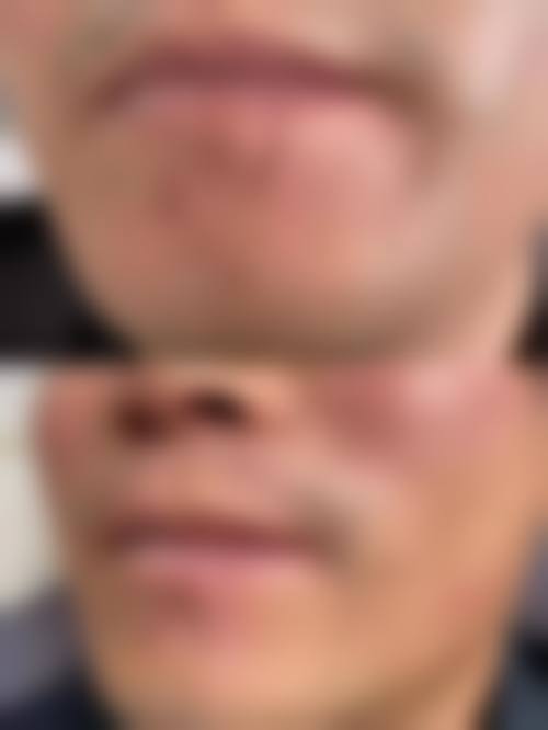柳州华 山医院整形美容科交通