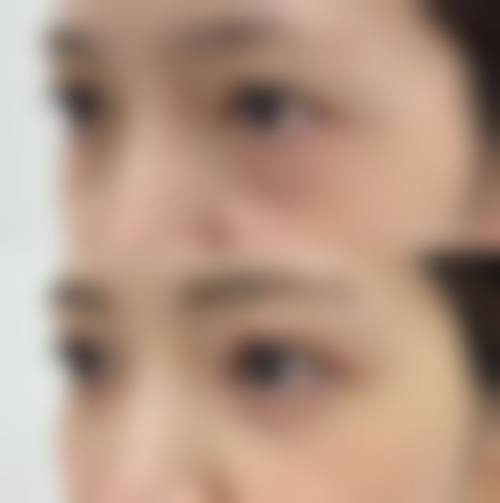 宜宾容貌医美整形实例参考