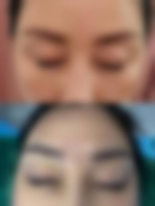 韩国Planner整形外科价格表(仅供参考)