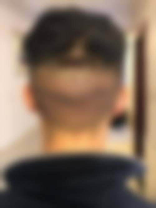 宁波新生植发医院擅长项目