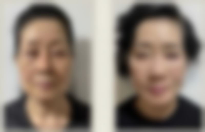苏州温家岸医疗美容门诊怎么预约?
