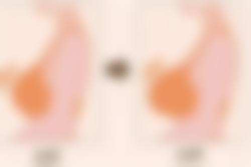 深圳美加美医疗美容整形医院实例参考