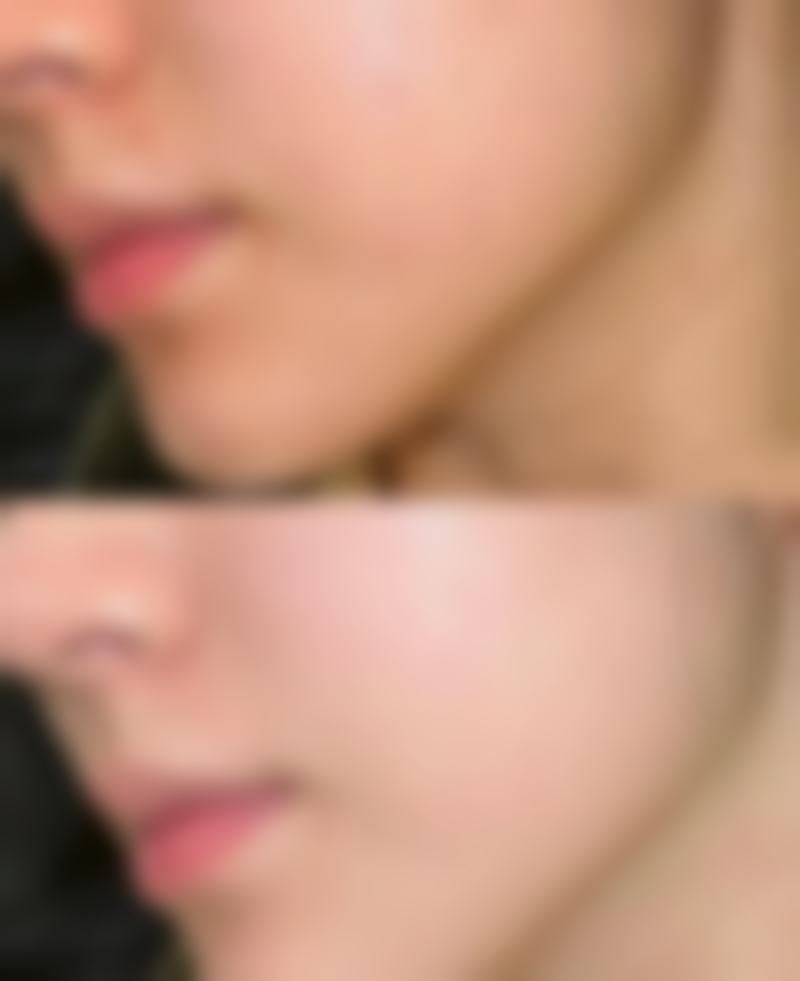 厦门华美整形医院擅长项目