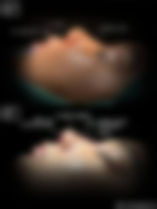 成都艾凡加医疗美容门诊部价格表(仅供参考)