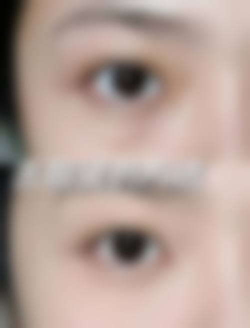成都天后整形医疗美容价格表(仅供参考)