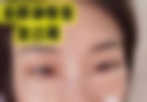 成都天后整形医疗美容实例参考