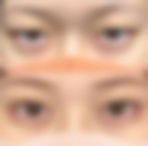 益阳瑞澜整形医院价格表（仅供参考）