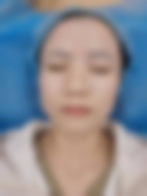 伊宁微领整形医院价格表（仅供参考）