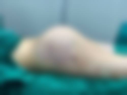 贵州六盘水利美康医疗美容实例参考