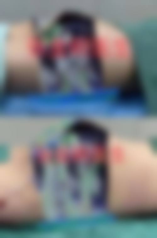 贵州六盘水利美康医疗美容擅长项目