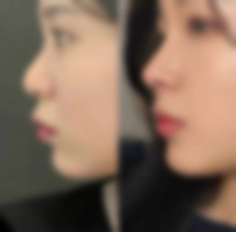 新乡京都易美医疗整形擅长项目