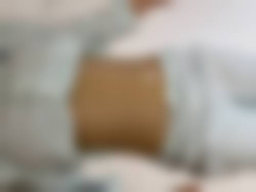 河南濮阳华美整形擅长项目