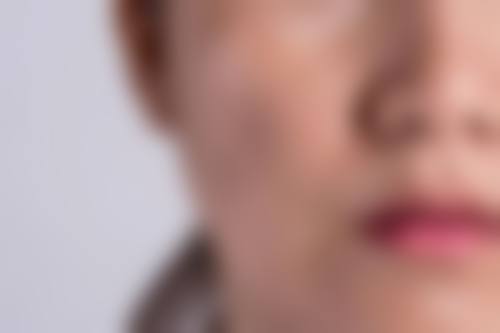 宁波江北尚美整形美容医院怎么预约?