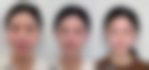 苏州美君医疗美容诊所怎么预约挂号?